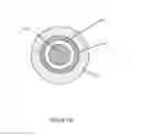 Fig. 03 - Stent graft fenestration