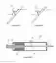 Fig. 06 - Stent graft fenestration