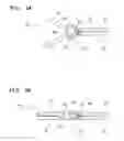 Fig. 04 - HIGH-FREQUENCY TREATMENT INSTRUMENT