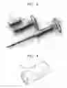Fig. 03 - ELECTRIC SCREWDRIVER FOR SPINAL FIXATION