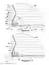 Fig. 10 - Retrieval device