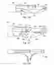 Fig. 20 - Retrograde instrument