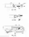 Fig. 23 - Retrograde instrument
