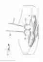 Fig. 06 - Vascular hole closure device