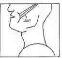 Fig. 01 - MINIMALLY INVASIVE TISSUE SUPPORT