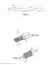 Fig. 02 - MINIMALLY INVASIVE TISSUE SUPPORT
