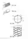 Fig. 04 - MINIMALLY INVASIVE TISSUE SUPPORT