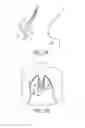 Fig. 15 - MINIMALLY INVASIVE TISSUE SUPPORT