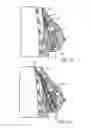 Fig. 17 - MINIMALLY INVASIVE TISSUE SUPPORT