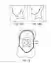 Fig. 24 - MINIMALLY INVASIVE TISSUE SUPPORT