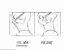 Fig. 25 - MINIMALLY INVASIVE TISSUE SUPPORT