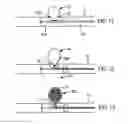 Fig. 07 - Aneurysm flow barrier