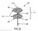 Fig. 10 - Aneurysm flow barrier