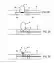 Fig. 11 - Aneurysm flow barrier