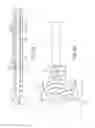 Fig. 02 - Vascular occlusion devices