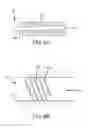 Fig. 05 - Vascular occlusion devices