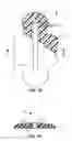 Fig. 03 - Biopsy incision closure device
