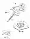 Fig. 08 - Biopsy incision closure device