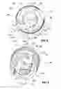 Fig. 04 - Anchoring element and method