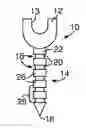 Fig. 01 - METHODS AND DEVICES FOR SPINAL FUSION