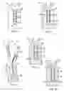 Fig. 03 - METHODS AND DEVICES FOR SPINAL FUSION