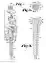 Fig. 02 - Pivotal bone anchor assemblies with pressure inserts and snap on articulating retainers