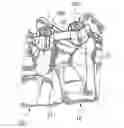 Fig. 01 - Spinal implant with a lockable ball joint