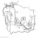 Fig. 01 - APPARATUS FOR DELIVERY OF PHARMACEUTICALS TO THE COCHLEA