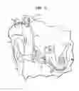 Fig. 02 - APPARATUS FOR DELIVERY OF PHARMACEUTICALS TO THE COCHLEA