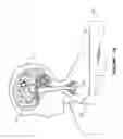 Fig. 03 - Method, system and apparatus for automated termination of a therapy for an epileptic event upon a determination of effects of a therapy