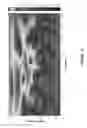 Fig. 10 - Method, system and apparatus for automated termination of a therapy for an epileptic event upon a determination of effects of a therapy