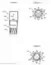 Fig. 03 - Aortic valve stent graft