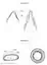 Fig. 07 - Aortic valve stent graft