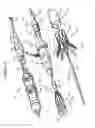 Fig. 09 - Aortic valve stent graft