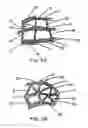Fig. 03 - INTRALUMINAL STENT GRAFT