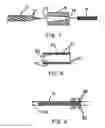 Fig. 05 - INTRALUMINAL STENT GRAFT