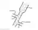 Fig. 01 - INTRALUMINAL SCAFFOLD HAVING AN ENLARGED PORTION