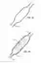 Fig. 09 - INTRALUMINAL SCAFFOLD HAVING AN ENLARGED PORTION