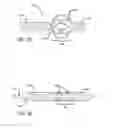Fig. 12 - INTRALUMINAL SCAFFOLD HAVING AN ENLARGED PORTION