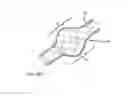 Fig. 14 - INTRALUMINAL SCAFFOLD HAVING AN ENLARGED PORTION