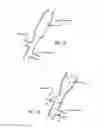 Fig. 17 - INTRALUMINAL SCAFFOLD HAVING AN ENLARGED PORTION