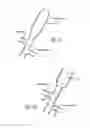 Fig. 17 - METHODS OF TREATING A CONDITION OF A VESSEL IN A PATIENT