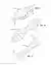 Fig. 18 - METHODS OF TREATING A CONDITION OF A VESSEL IN A PATIENT