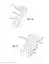 Fig. 19 - METHODS OF TREATING A CONDITION OF A VESSEL IN A PATIENT