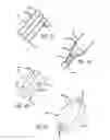 Fig. 20 - METHODS OF TREATING A CONDITION OF A VESSEL IN A PATIENT