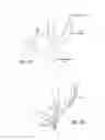 Fig. 23 - METHODS OF TREATING A CONDITION OF A VESSEL IN A PATIENT