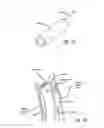 Fig. 27 - METHODS OF TREATING A CONDITION OF A VESSEL IN A PATIENT