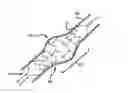 Fig. 01 - INTRALUMINAL SCAFFOLD WITH CONFORMING AXIAL STRUT