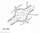Fig. 14 - INTRALUMINAL SCAFFOLD WITH CONFORMING AXIAL STRUT
