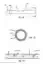 Fig. 25 - INTRALUMINAL SCAFFOLD WITH CONFORMING AXIAL STRUT